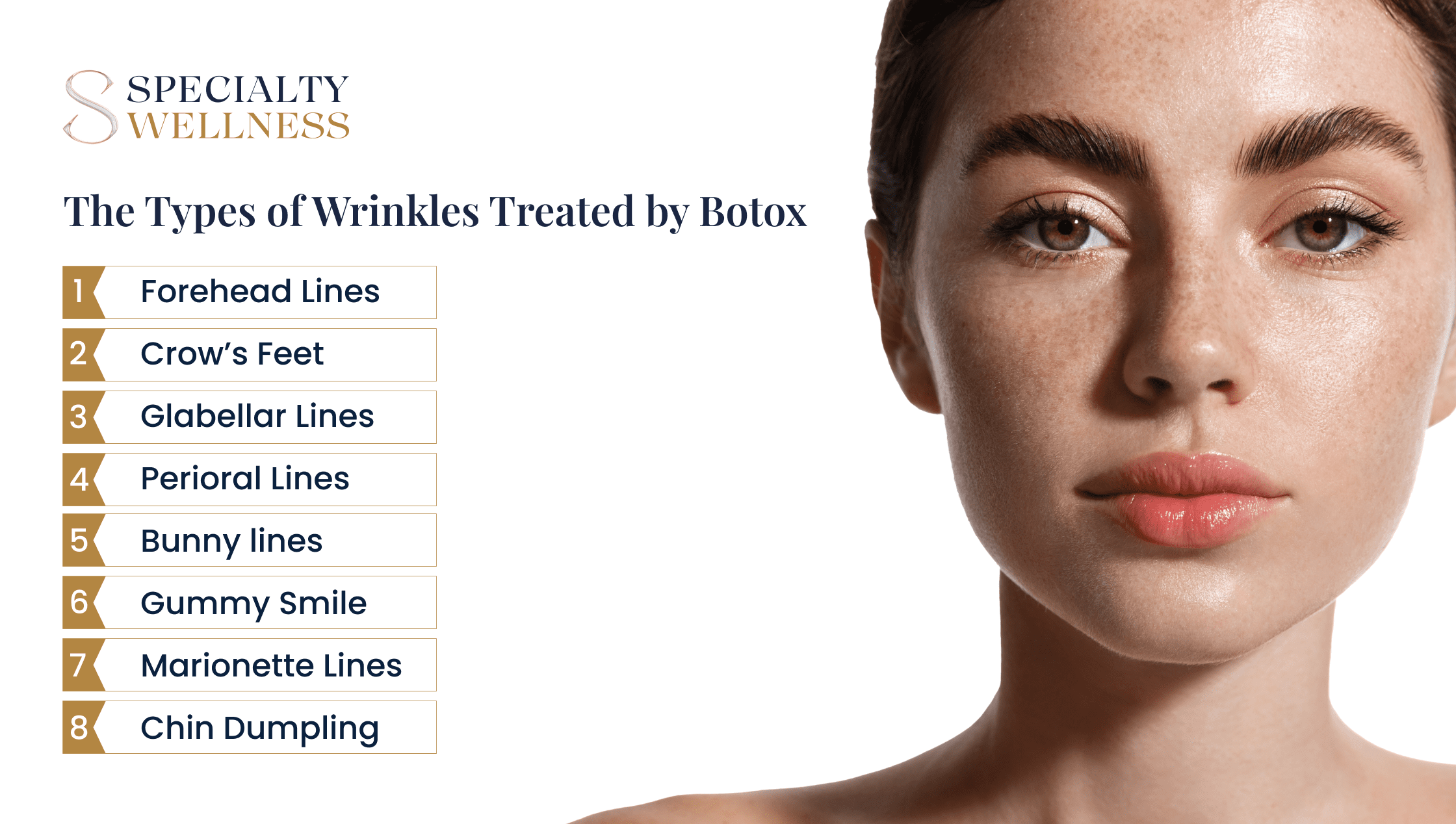 The Types of Wrinkles Treated by Botox