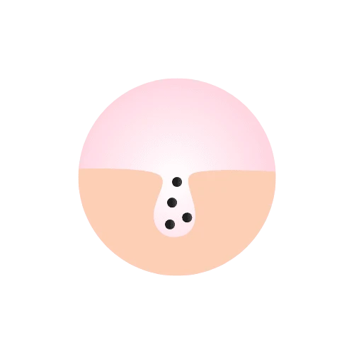 Large Pores