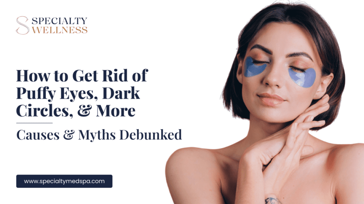 How to Get Rid of Puffy Eyes, Dark Circles, & More: Causes & Myths Debunked