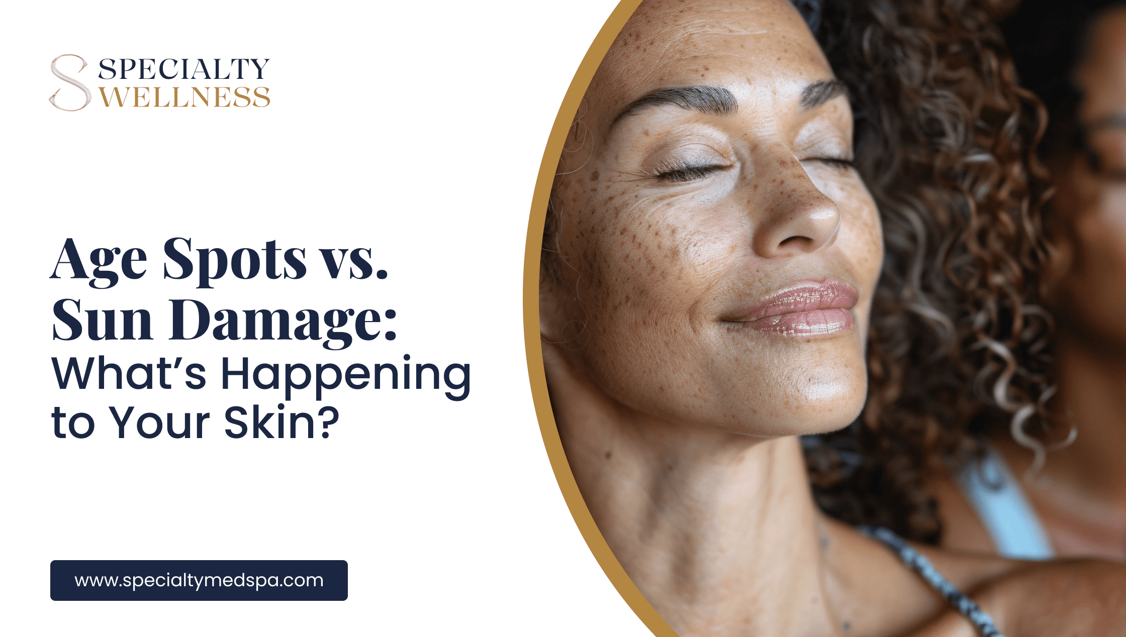Age Spots vs Sun Damage: What’s Happening to Your Skin?