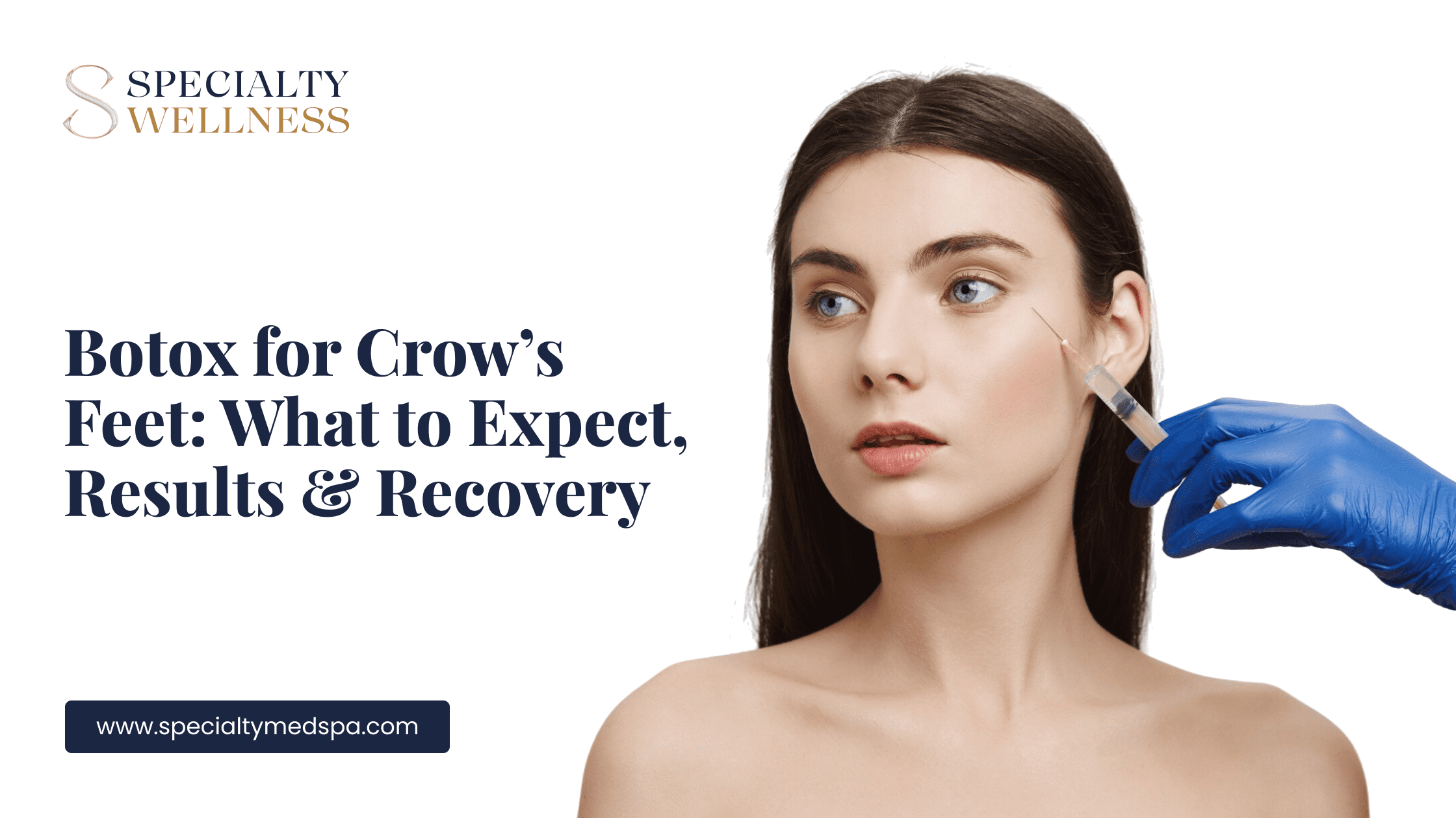 Botox for Crow’s Feet: What to Expect, Results & Recovery