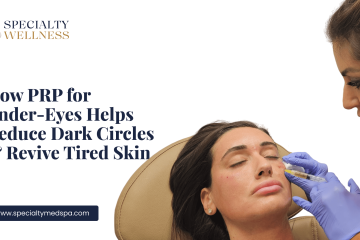 How PRP for Under Eyes Helps Reduce Dark Circles & Revive Tired Skin
