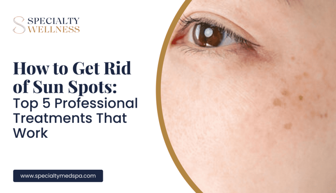 How to Get Rid of Sun Spots_ Top 5 Professional Treatments That Work