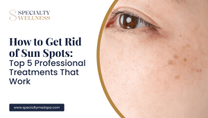How to Get Rid of Sun Spots_ Top 5 Professional Treatments That Work