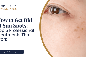 How to Get Rid of Sun Spots_ Top 5 Professional Treatments That Work