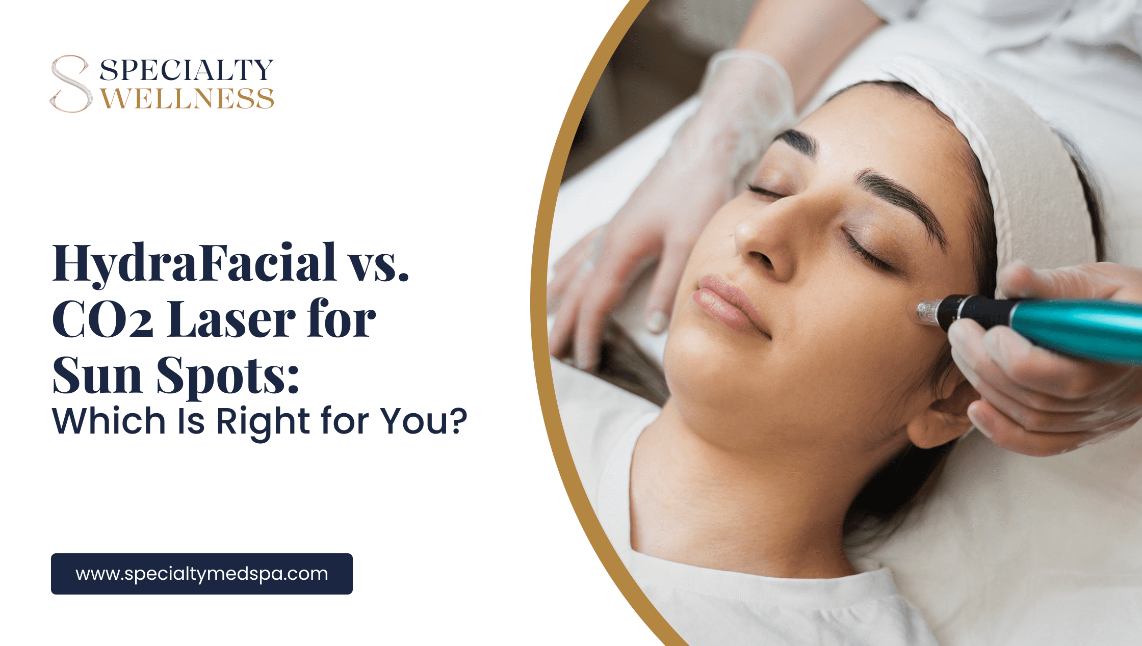 HydraFacial vs. CO2 Laser for Sun Spots: Which Is Right for You?
