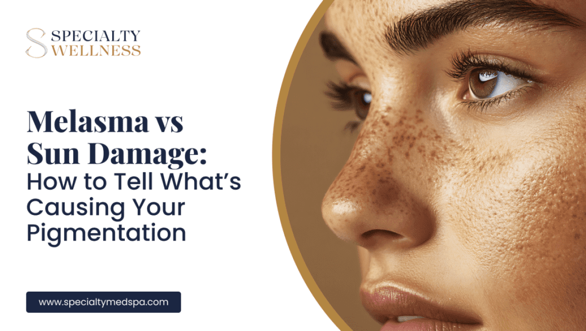 Melasma vs Sun Damage: How to Tell What’s Causing Your Pigmentation