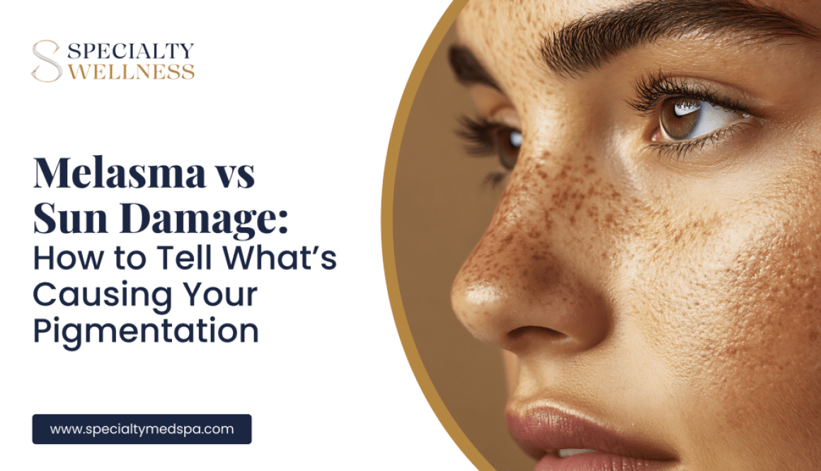 Melasma vs Sun Damage_ How to Tell What’s Causing Your Pigmentation
