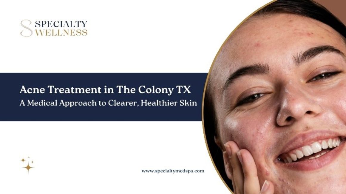 Acne Treatment in The Colony TX: A Medical Approach to Clearer, Healthier Skin