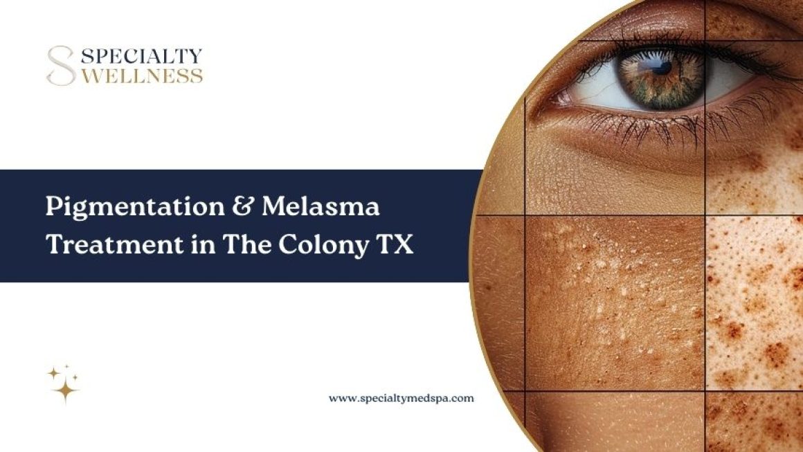 Pigmentation & Melasma Treatment in The Colony TX: Restore an Even, Radiant Skin Tone