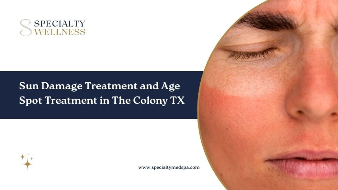 Sun Damage Treatment and Age Spot Treatment in The Colony TX