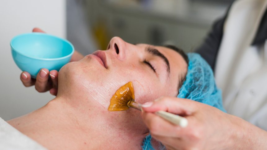 Chemical peels for pigmentation treatment in The Colony TX