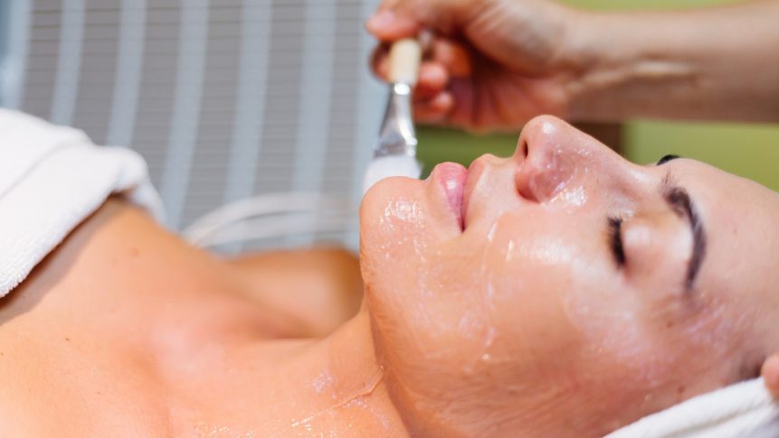 Chemical peel treatment for sun damage in The Colony TX