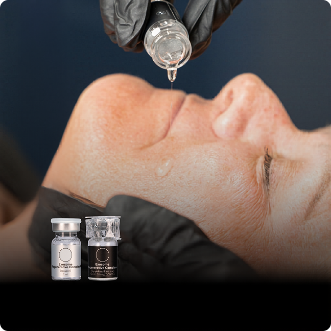 Exosomes Regenerative Therapy (1)