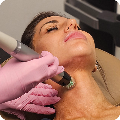 RF Microneedling