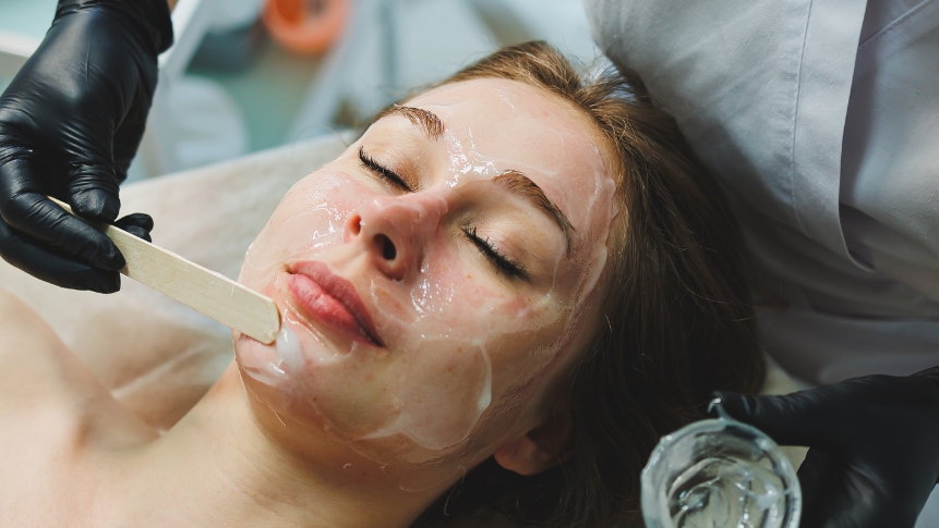 Chemical peel dull skin treatment before and after results