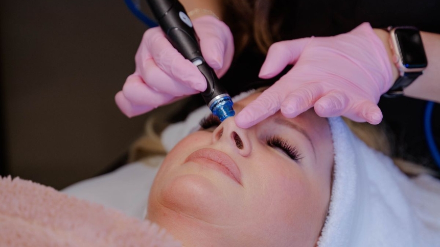 HydraFacial dull skin treatment improving hydration and glow