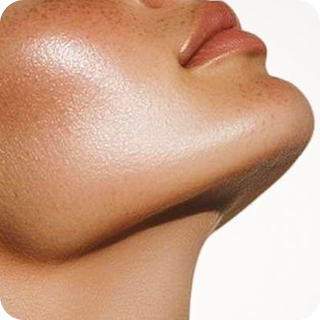 Chin
